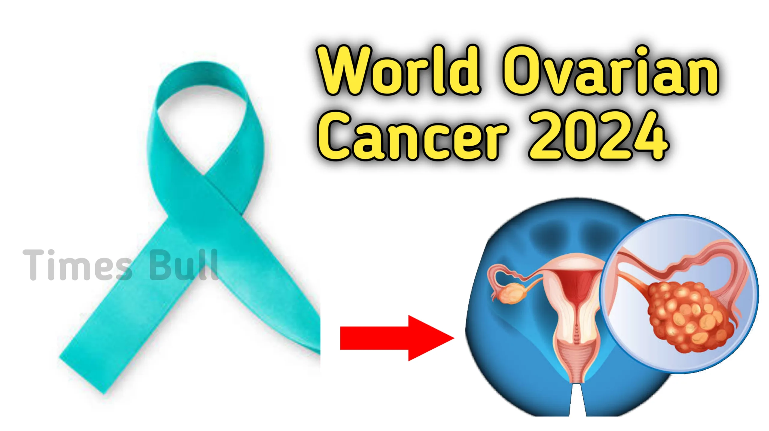 World Ovarian Cancer Day 2024: ओवेरियन कैंसर से संबंधित 3 मिथक ना करे यकीन, जाने मिथक के राज!