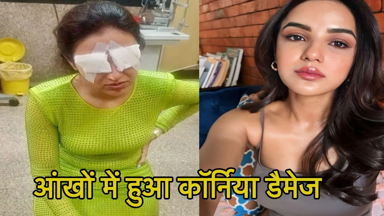 लेंस लगाने के बाद जलने...