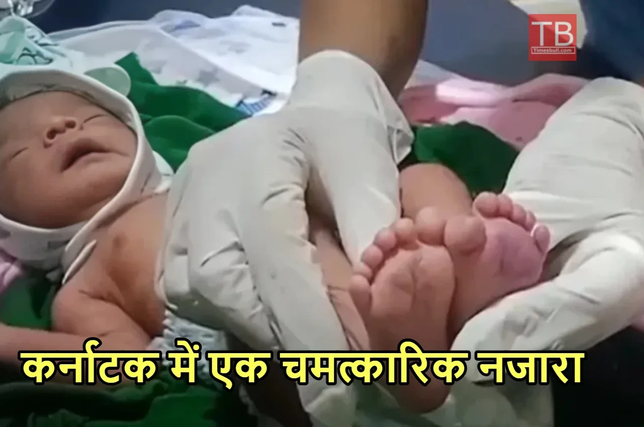 25 अंगुली लेकर पैदा हुआ...