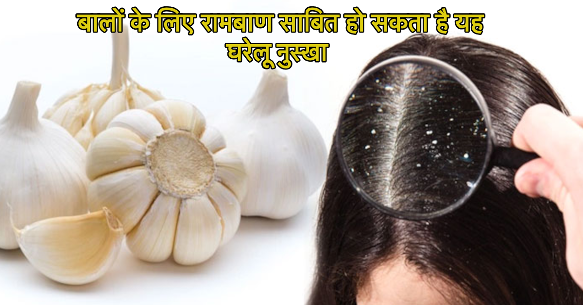 Hair Care Tips: बालों