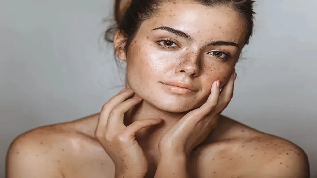 Pigment Spots Explained: Effective Tips...