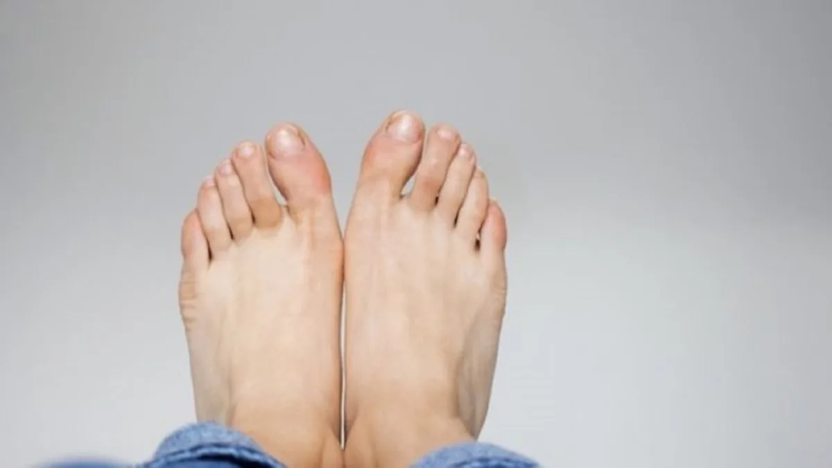 Remove Calluses These Tips Will Make Your Feet Soft Again