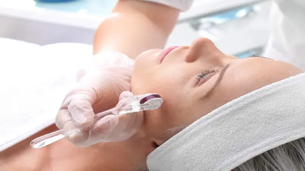 Smooth and Glowing How Dermaroller Microneedling Enhances Your Skin