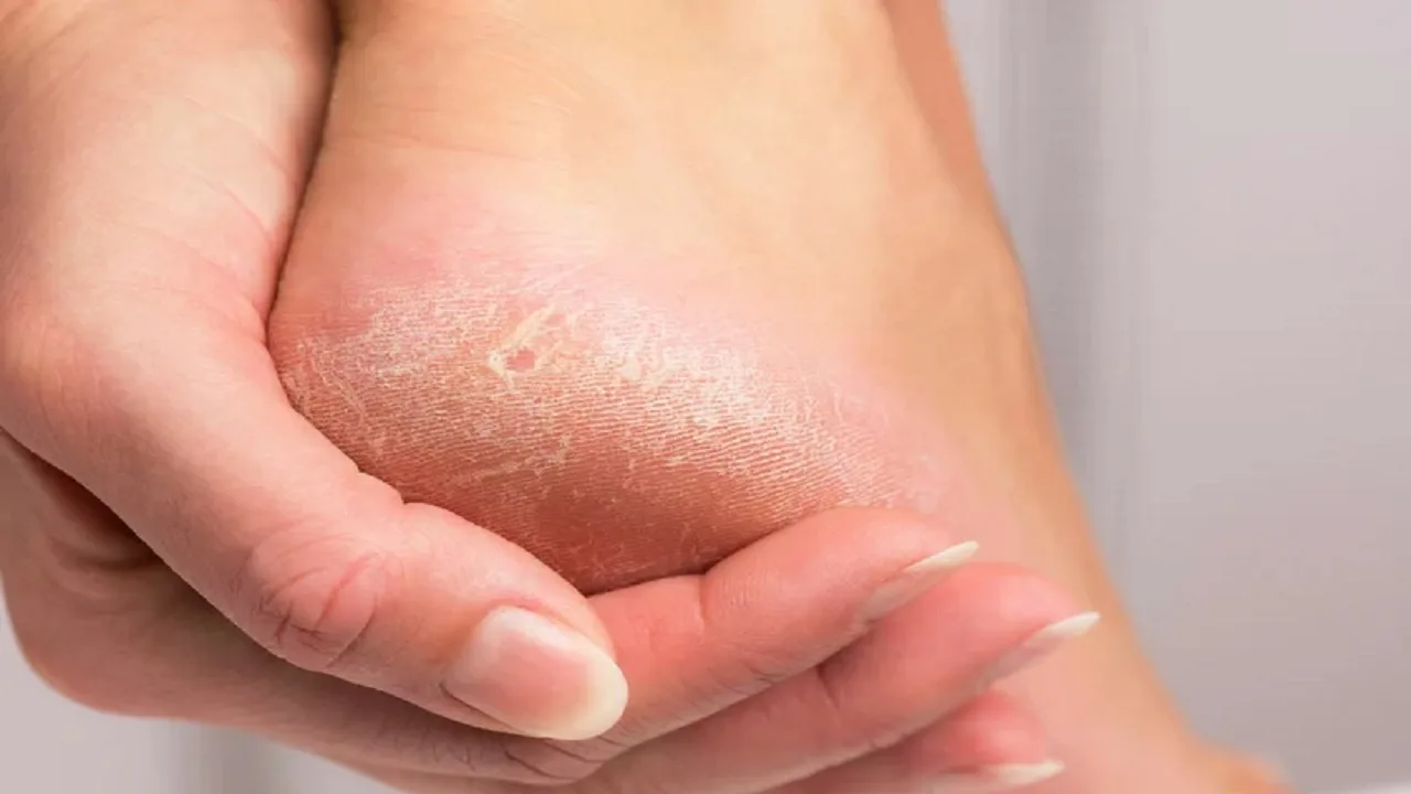 Soft Feet Secrets: How to...