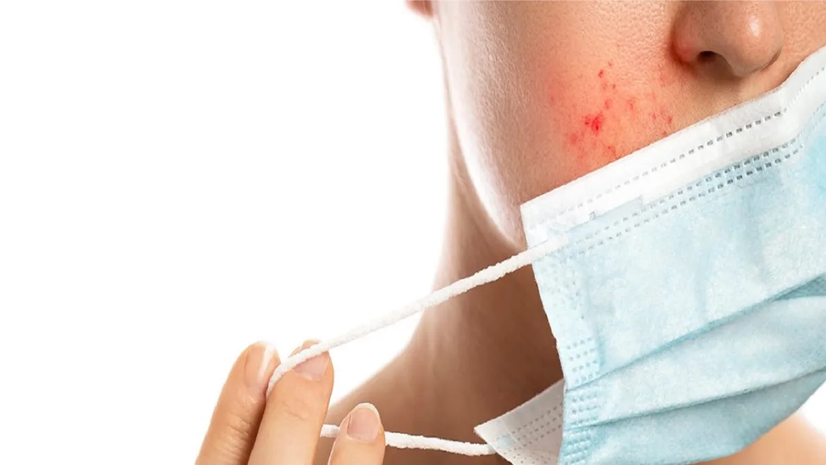 Mask Acne (maskne) What Causes It, How To Recognize It, And How To Reduce It