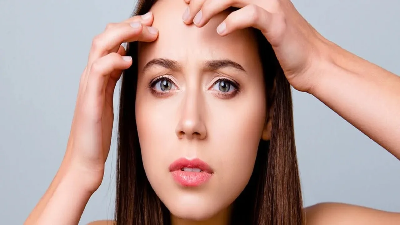 Pimples on Forehead: Causes, Treatment...