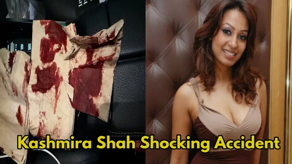 Kashmira Shah's Shocking Accident