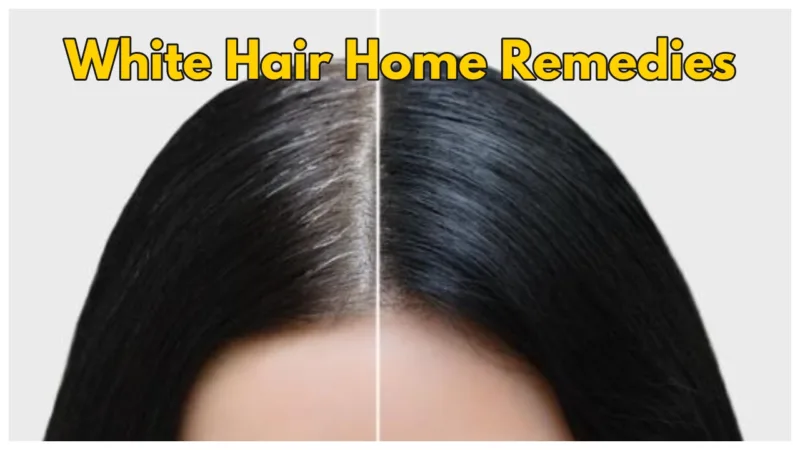White Hair Home Remedies