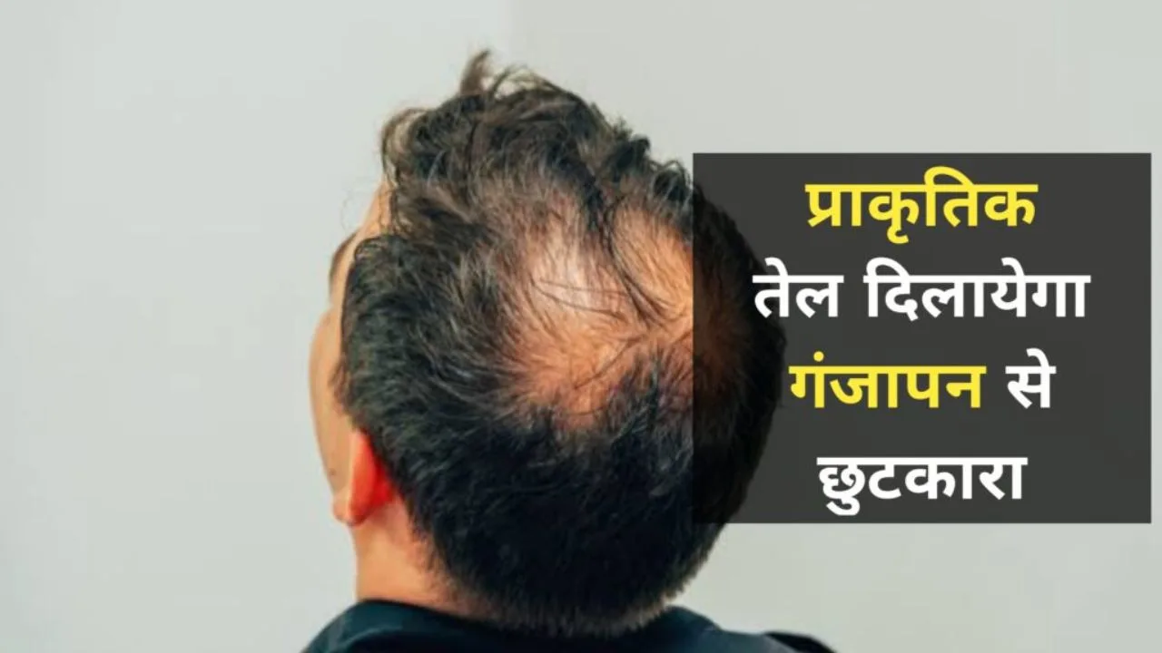 Home Remedies for hair growth:...