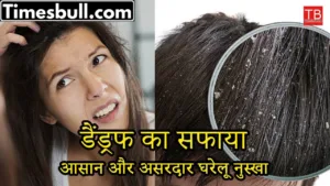 Dandruff treatment at home: Eliminate dandruff at home in an easy way