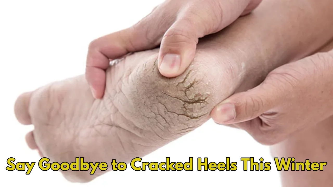 Struggling with Cracked Heels? Simple...
