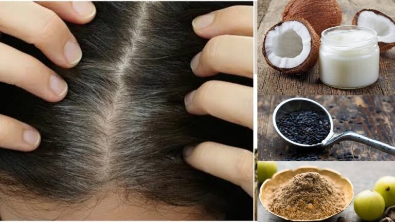 3 Home Remedies to Get Rid of White Hair Naturally