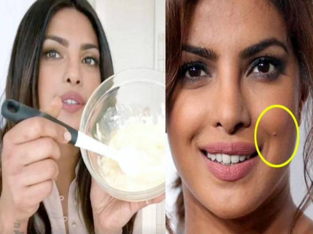 Curd For Face