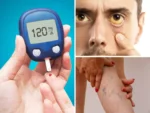 Diabetes Symptoms