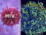 HIV AIDS