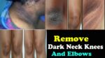  Neck Dirt and Dark Elbows Remove Trick