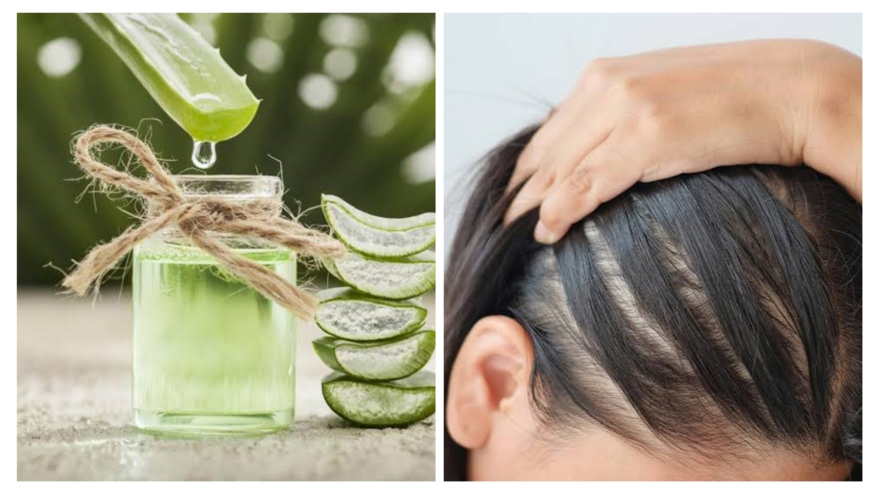 Hair Care Tips: सिर में...