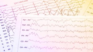 Sermorelin Peptide: Exploring Its Potential in Sleep Research and Beyond