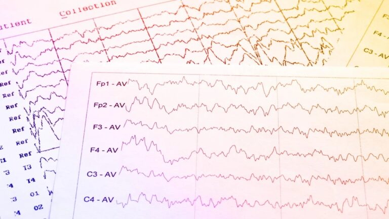 Sermorelin Peptide: Exploring Its Potential in Sleep Research and Beyond