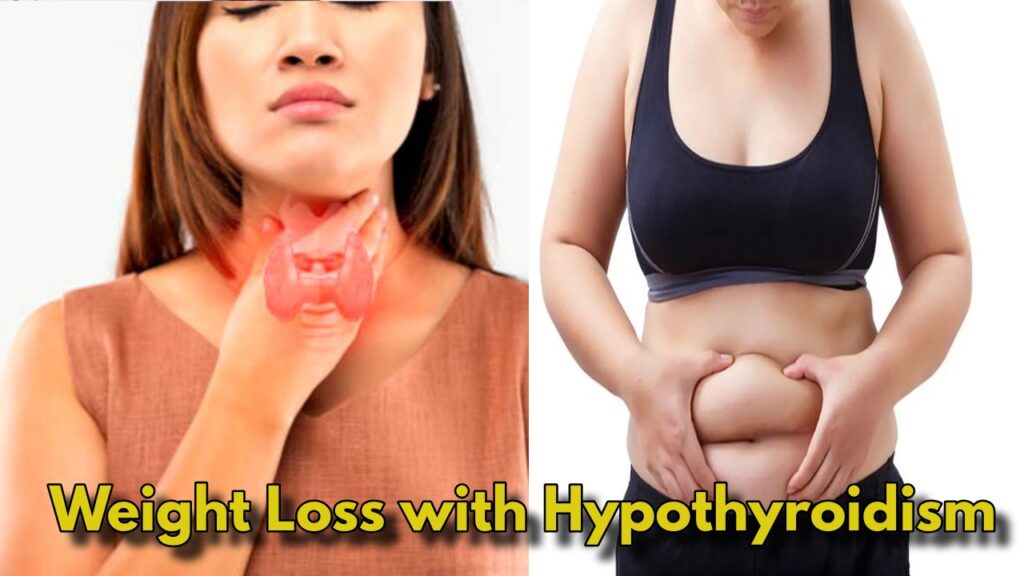 Struggling with Hypothyroidism? These 5 Tips Can Help You Lose Weight Naturally