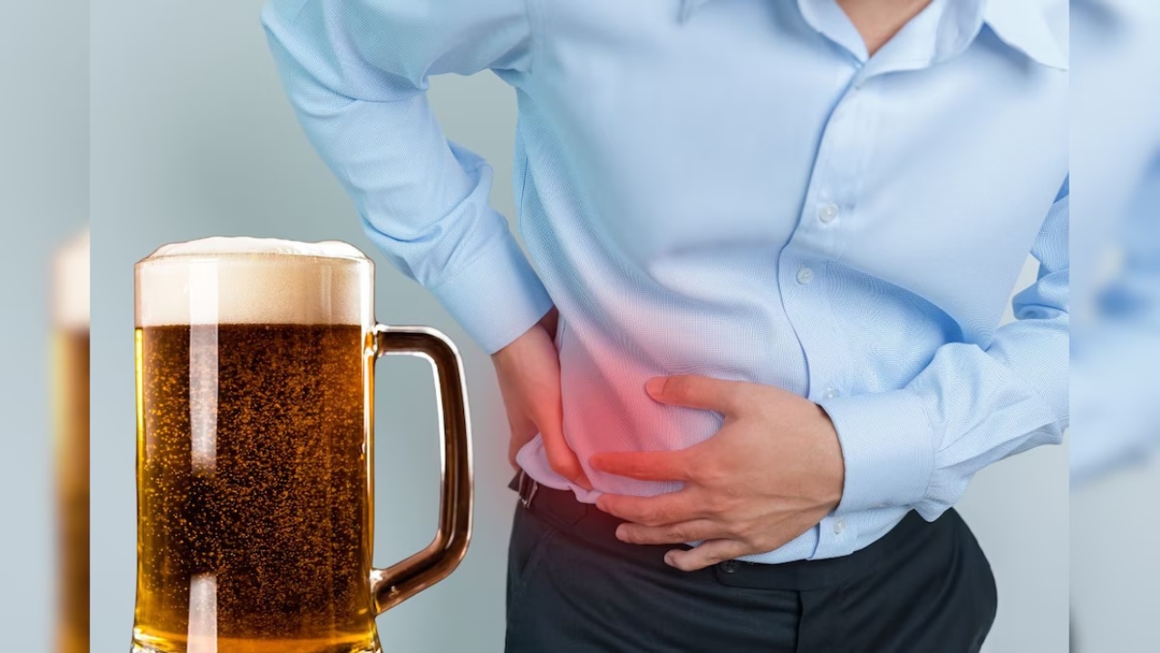 Beer for Kidney Stones