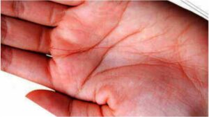 Fate Line in Palmistry – What Its Shape, Breaks and Position Reveal About Your Life