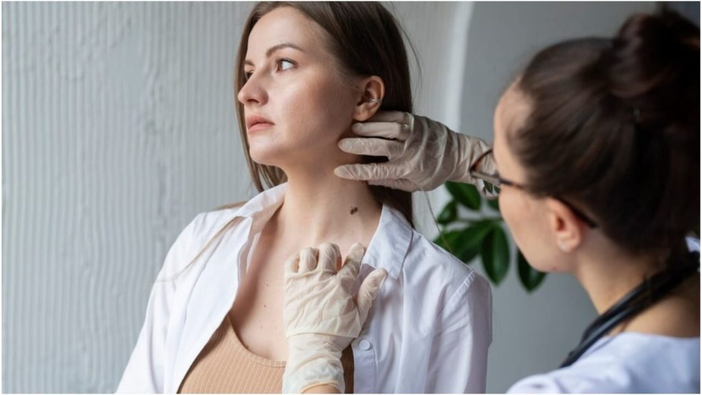 Skin Cancer Symptoms